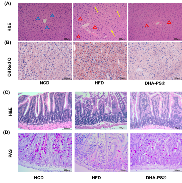 Effect of DHAPS® on the histopathology of liver (A-B) and intestine (C-D) in the HFD mice