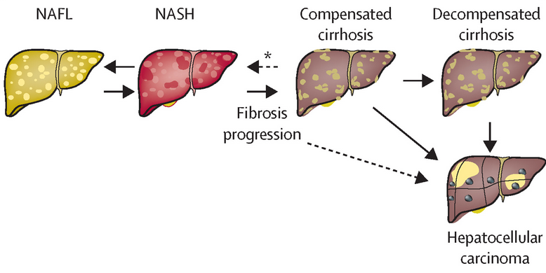 The Potential of DHA-Enriched Phosphatidylserine in Combating NAFLD and Intestinal Dysbacteriosis